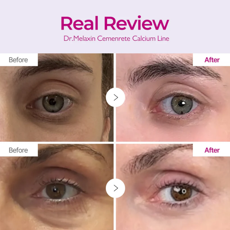 Korean Calcium Dark Spot Eye Cream