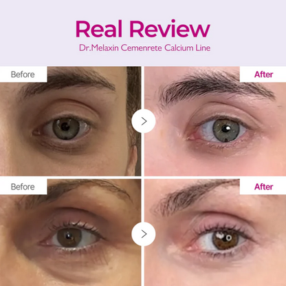 Korean Calcium Dark Spot Eye Cream