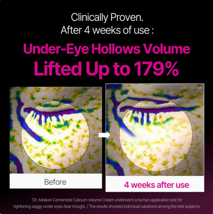 Korean Calcium Dark Spot Eye Cream